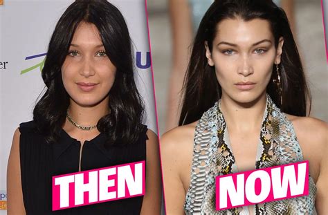 Bella Hadid on Her Plastic Surgery History and Being。